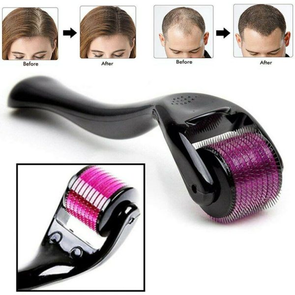 Derma Roller 540 — engineered with 540 premium titanium micro-needles (0.5mm) to support effective hair regrowth and follicle stimulation.