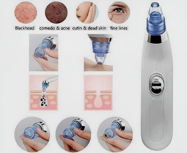 DERMA SUCTION – Blackhead, Acne & Oil Remover Vacuum